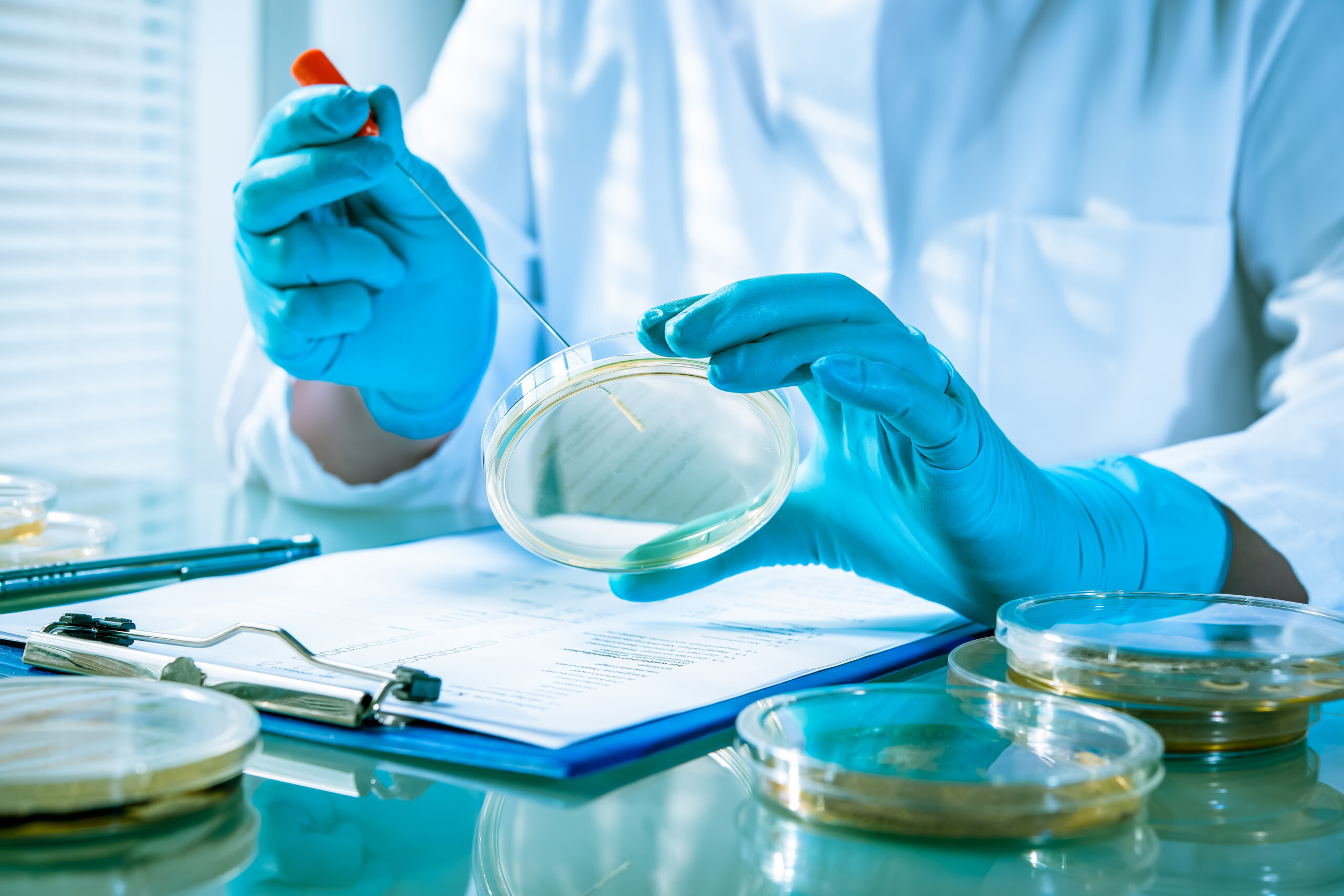 Germs growing on an agar plate in laboratory